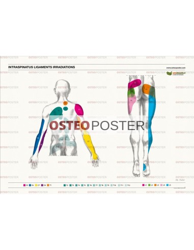 Osteoposter - Irradiazione Legamenti Interspinosi Dorsale