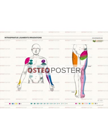 Osteoposter - Irradiazione Legamenti Interspinosi Frontale